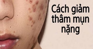 Cách trị thâm mụn nặng áp dụng được cho mọi loại da